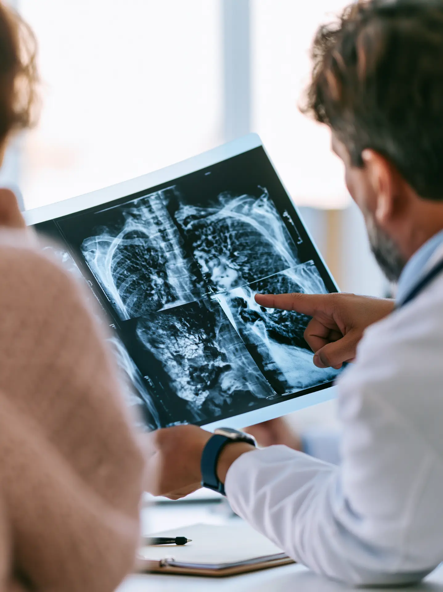 Medic pneumolog explicând unui pacient imaginile radiologice pulmonare