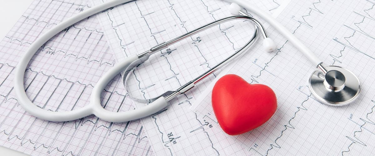 Extrasistole ventriculare: ce sunt, cauze, simptome, tratament